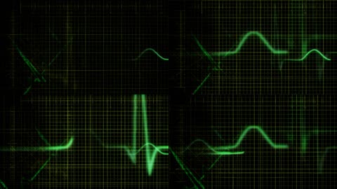 心跳旋律跳动仪器显示屏网格光效心跳反应视频素材