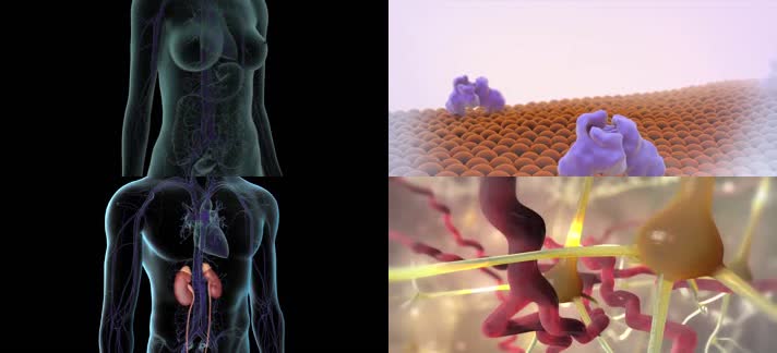 3D2型糖尿病原因治疗医疗视频