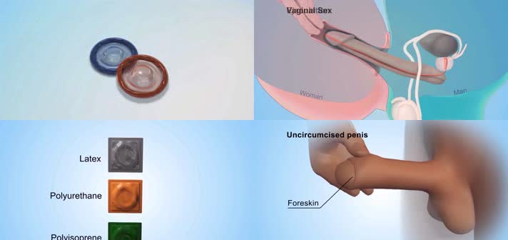 3D避孕套正确使用方法医疗视频
