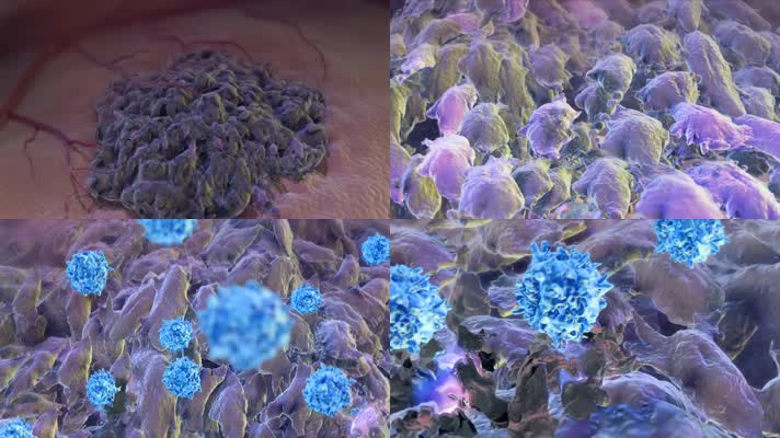 3D肿瘤破坏免疫系统医疗视频