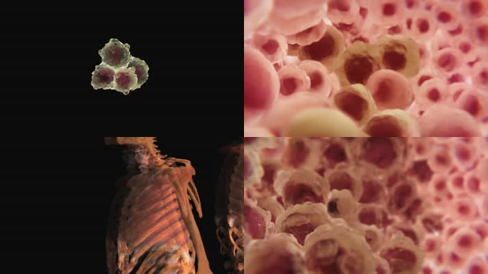 人体癌症癌细胞