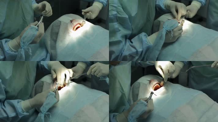 看牙科 牙医 牙科手术 牙齿手术 