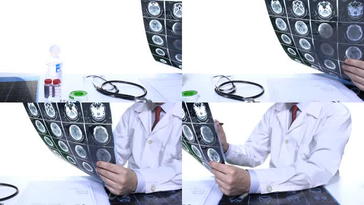 医生看x光 x光片 诊断 拍片 