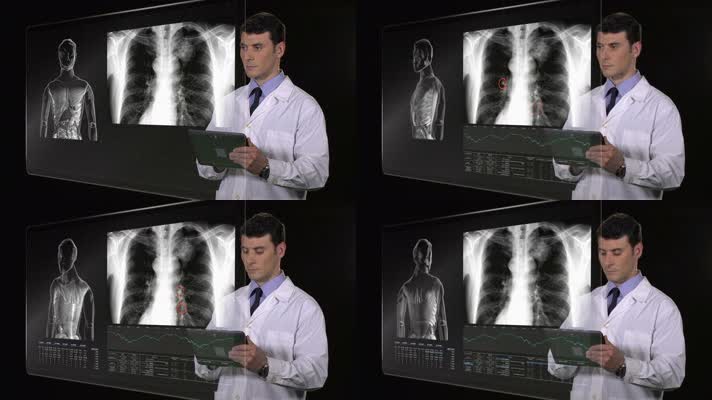 医生看x光 x光片 诊断 拍片 