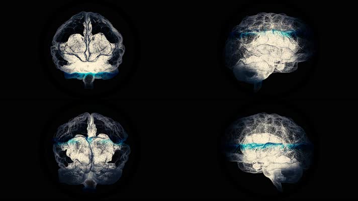 大脑X光扫描