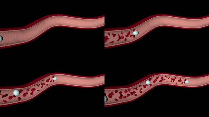 血管血液流动三维机理动画视频素材