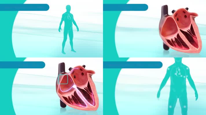 心脏跳动心跳心房颤动人体三维机理动画