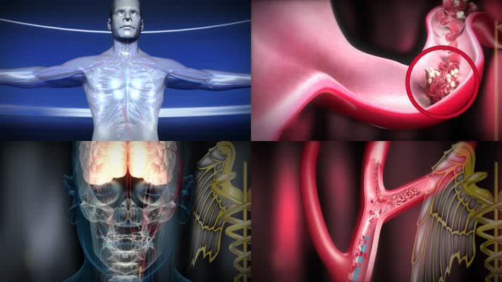人体机理三维动画3D医学动画