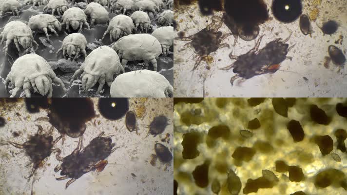 螨虫细菌虱子3d动画卫生防疫疾病传播