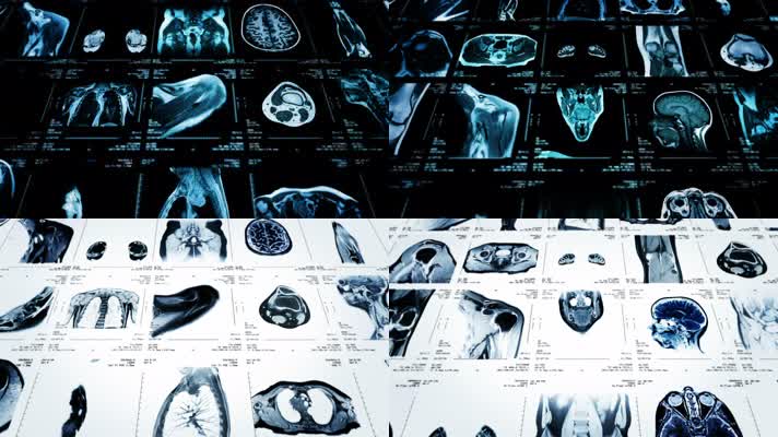 CT拍片生命医学影像医疗科技图像