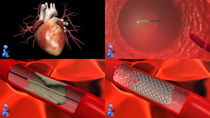 心脏跳动血液心血管疾病医学3D动画
