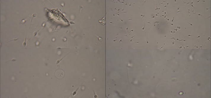 显微镜观察精子细胞动画