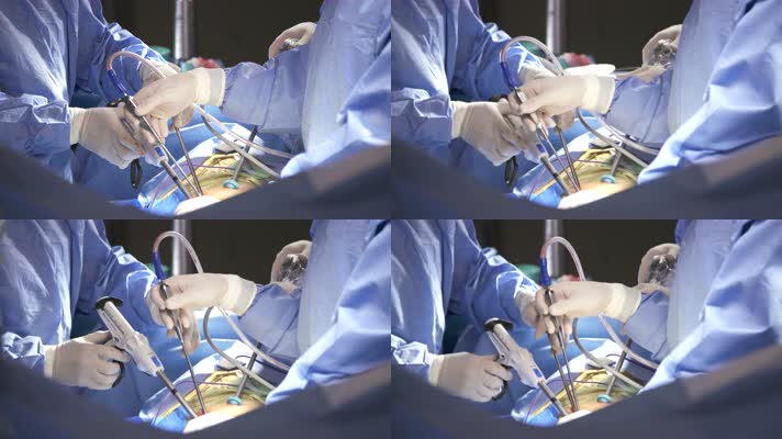 抢救病人 医生做手术 实拍手术 4K视频