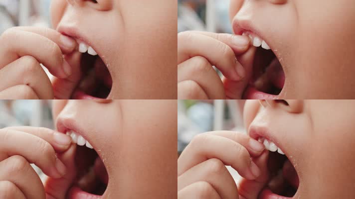 儿童换牙，用手指掰牙齿