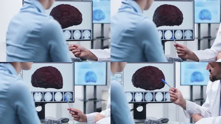 脑部研究疾病，讲解CT扫描