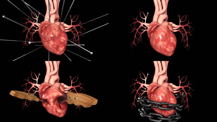 心脏痛如刀搅心脏病视频素材
