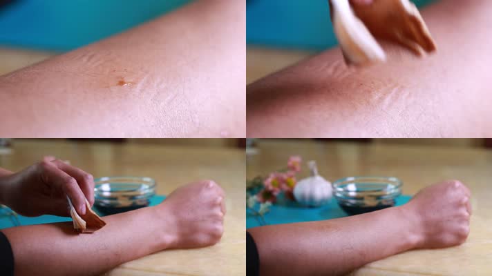 涂抹 护肤 清洁 手 皮肤 过敏 (1)