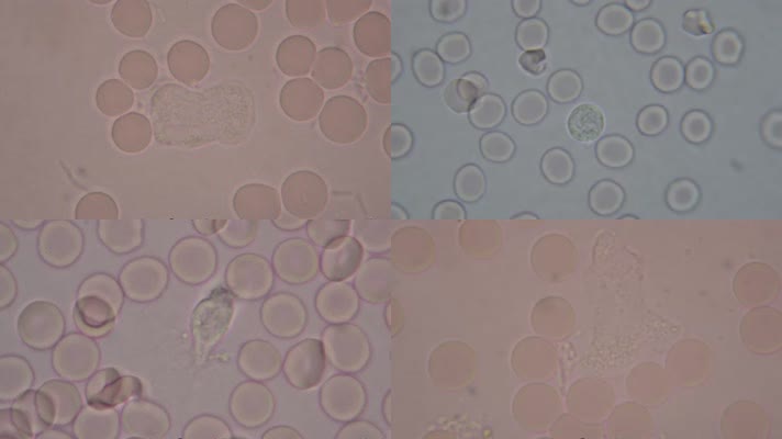  显微镜下白细胞