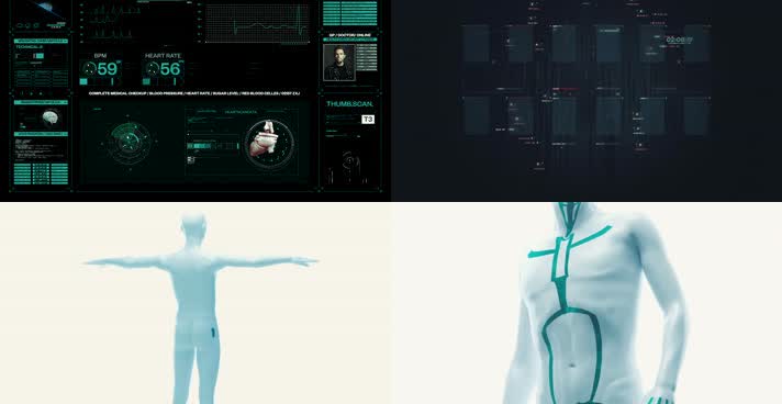 3D医疗动画-大数据分析