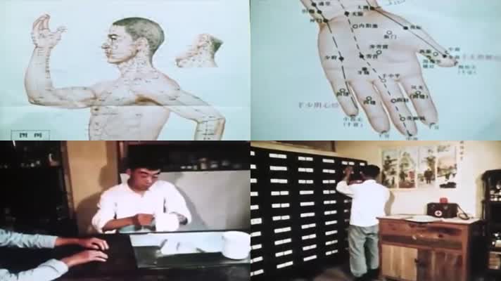 60年代的农村医疗赤脚医生影像10