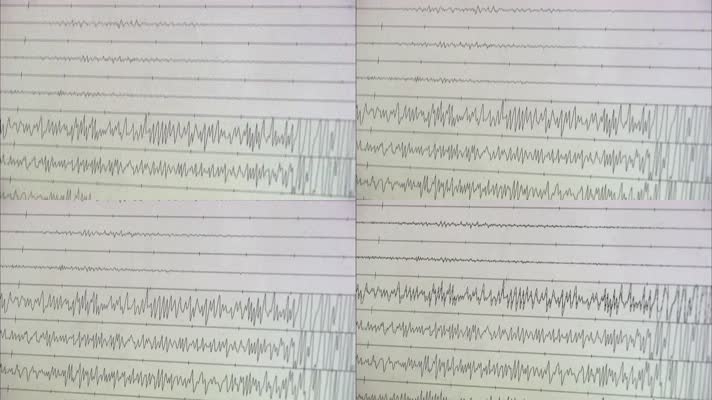 地震检测记录波形图