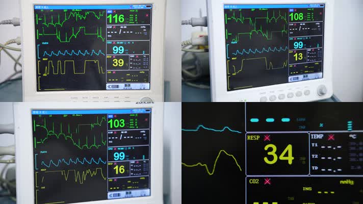医院身体心脉搏率检测仪