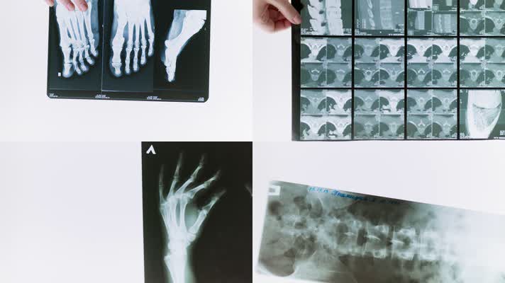 人体X光片